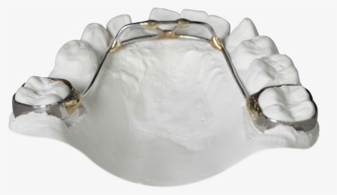 Orthodontics, HD Png Download, Transparent PNG