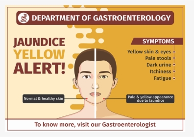 Gastroenterology Jaundice - Poster, HD Png Download, Transparent PNG