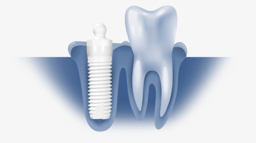 Z5mlb/z5mlb Ceramic Dental Implant By Z-systems - Chair, HD Png Download, Transparent PNG