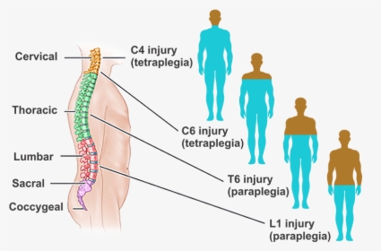 What Is Spinal Cord Injury - Spinal Cord Injury Transparent, HD Png Download, Transparent PNG