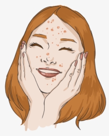 Cute Pimples, HD Png Download, Transparent PNG