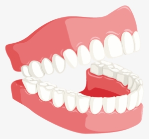 Smiling Denture - Tongue Position Front, HD Png Download, Transparent PNG