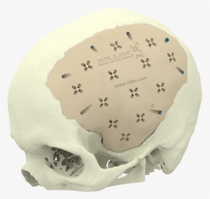 Xilloc Medical B - Skull, HD Png Download, Transparent PNG