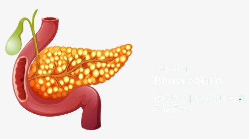 Homeopathic Treatment For Pancreatitis, HD Png Download, Transparent PNG