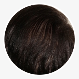 After Hair Restoration In A Circular Picture - Blond, HD Png Download, Transparent PNG