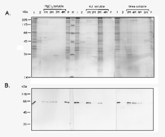 Silver-stained Sds 12% Polyacrylamide Gel Of Triton - Architecture, HD Png Download, Transparent PNG