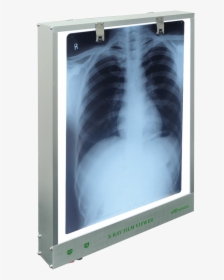 Single Sided Led X Ray Viewer Style Max Height - X Ray Film Viewer, HD Png Download, Transparent PNG