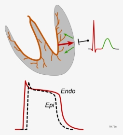 Ecg T Wave Formation - T Wave Repolarization, HD Png Download, Transparent PNG