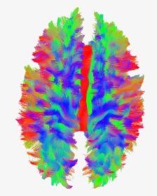 This Picture Illustrates The Nerve Fibers Of The Brain, HD Png Download, Transparent PNG