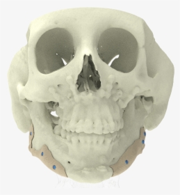 Xilloc Medical B - Skull, HD Png Download, Transparent PNG