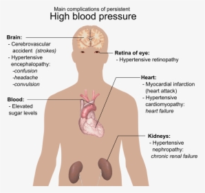 Main Complications Of Persistent High Blood Pressure - High Blood Pressure Nails, HD Png Download, Transparent PNG