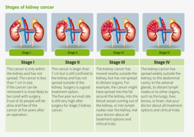 Kidney Tumor Stages, HD Png Download, Transparent PNG