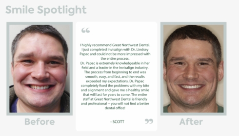 Smile Spotlight Template - Invisalign Before And After, HD Png Download, Transparent PNG