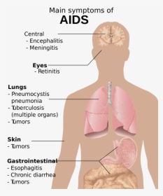 Hiv Aids Png 2-2 Free Photo - Main Symptoms Of Aids, Transparent Png, Transparent PNG