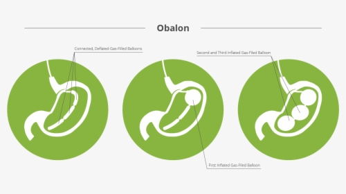 Obalon - Graphic Design, HD Png Download, Transparent PNG