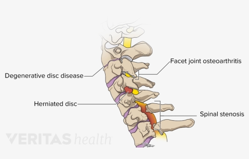 Medical Illustration Of Common Problems Affecting The, HD Png Download, Transparent PNG