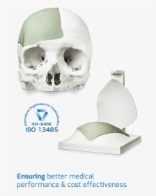 Cement Cranial Implant - Skull, HD Png Download, Transparent PNG