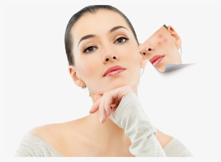 Acne, HD Png Download , Transparent Png Image - PNGitem