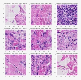 Histopathologic Cancer Detection, HD Png Download, Transparent PNG