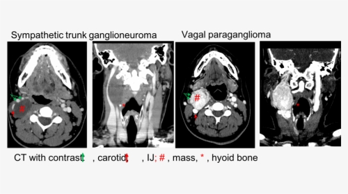 Radiology, HD Png Download, Transparent PNG