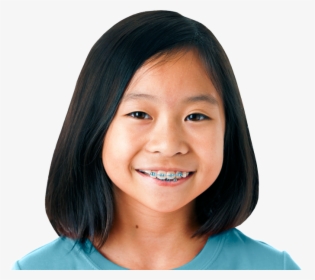 Girl With Braces Png, Transparent Png, Transparent PNG