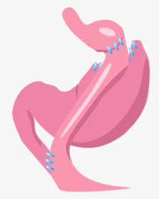 Gastric Bypass, HD Png Download, Transparent PNG